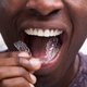 Illustration for article titled And Heres Why You Shouldnt Pick a Dentist Based On A Radio Ad